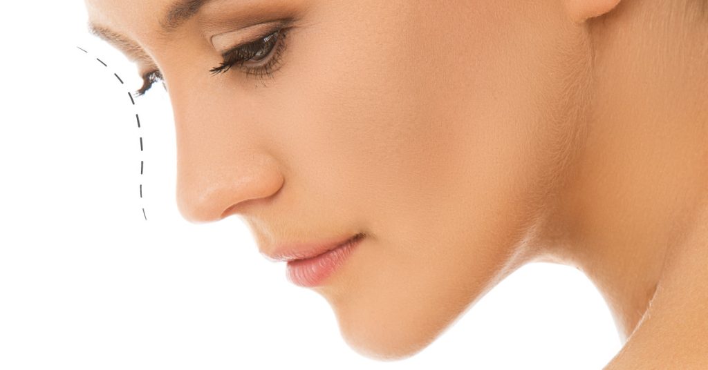 Rinomodelación con Ácido Hialurónico